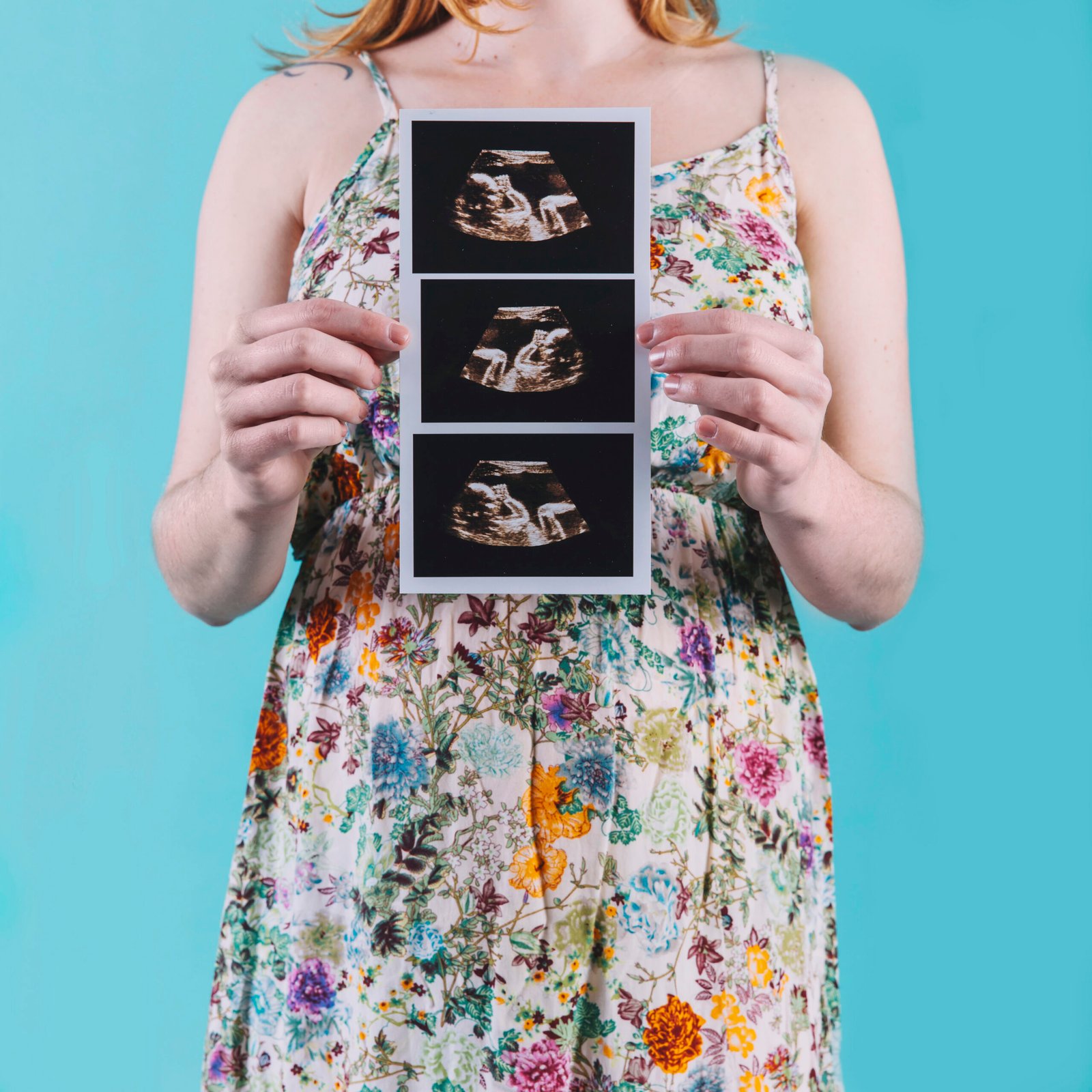 Pregnant woman holding an ultrasound photo
